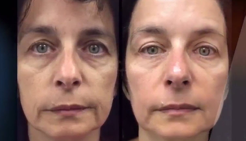 Before & After With Eminence Organics